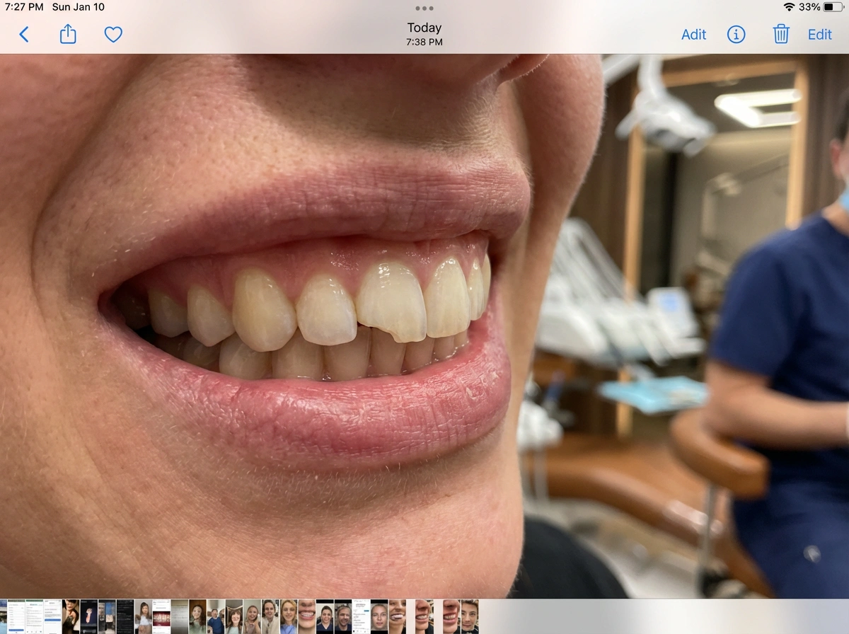 Consultation photo before the hairstyle preview